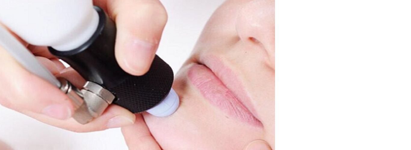 Microdermabrasion to forehead slide