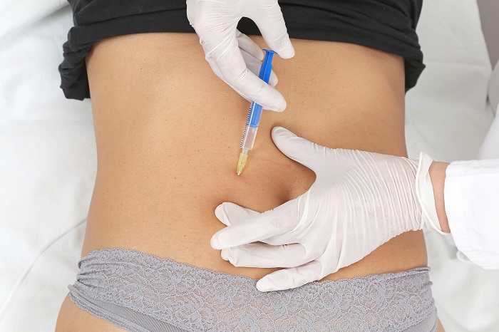 Woman receiving Aqualyx injection to stomach