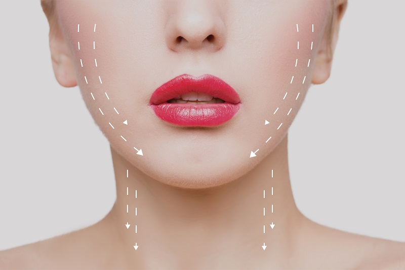 Collagen Lift Treatment Areas